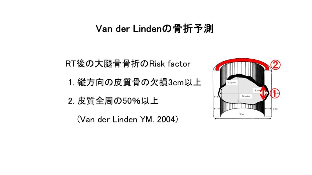 Van der Lindenの骨折予測